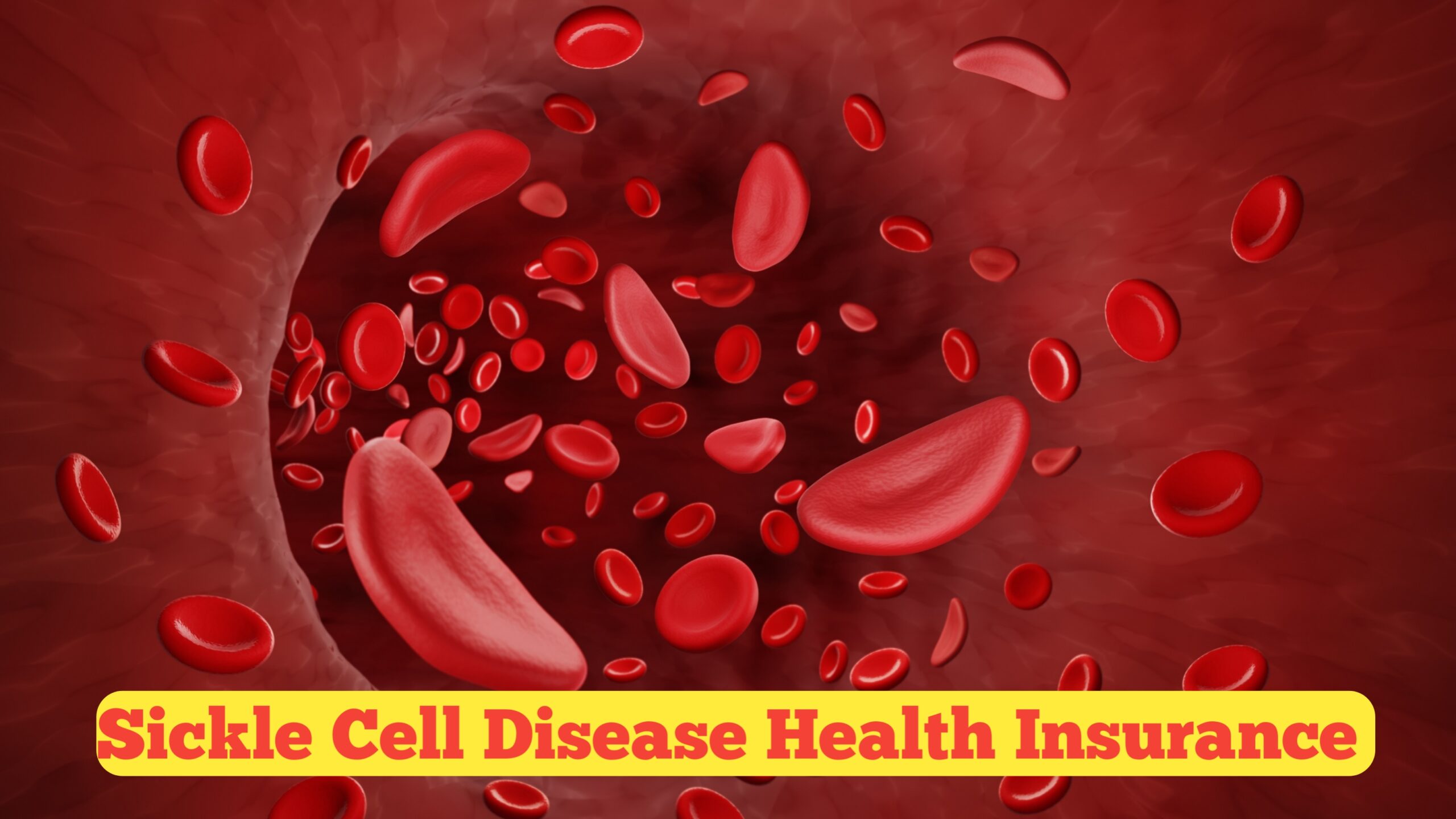 Sickle Cell Disease Health Insurance : A Complete Guide to Coverage, Costs, and Smart Choices